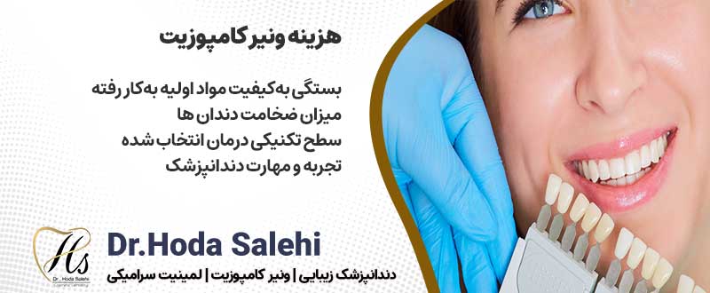 هزینه کامپوزیت دندان در اصفهان | دکتر هدی صالحی