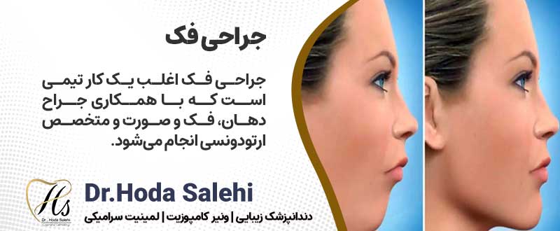 دکتر هدی صالحی| اصلاح طرح لبخند لثه ای با انجام جراحی فک
