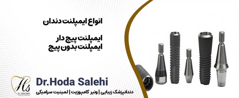 دکتر هدی صالحی| دندانپزشک زیبایی در اصفهان انواع ایمپلنت دندان
