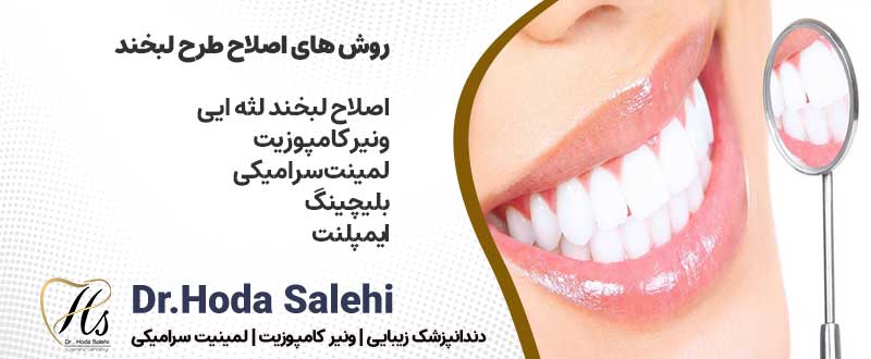 روش های اصلاح طرح لبخند در اصفهان