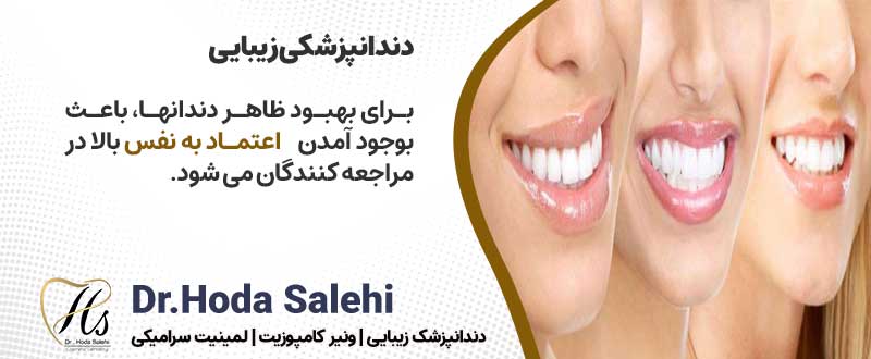 دکتر هدی صالحی| دندانپزشکی زیبایی در اصفهان