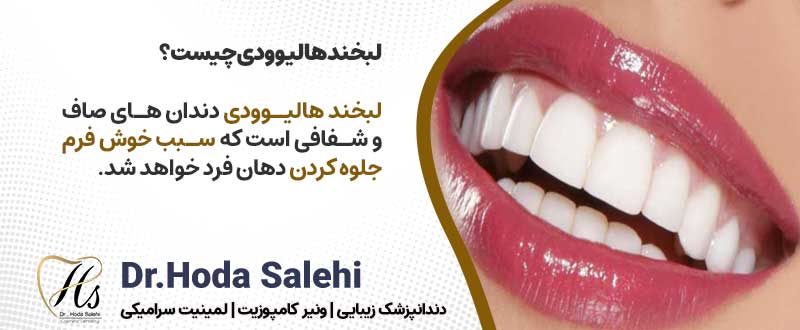 لبخند هالیوودی چیست؟ دکتر هدی صالحی|دندانپزشک زیبایی در اصفهان