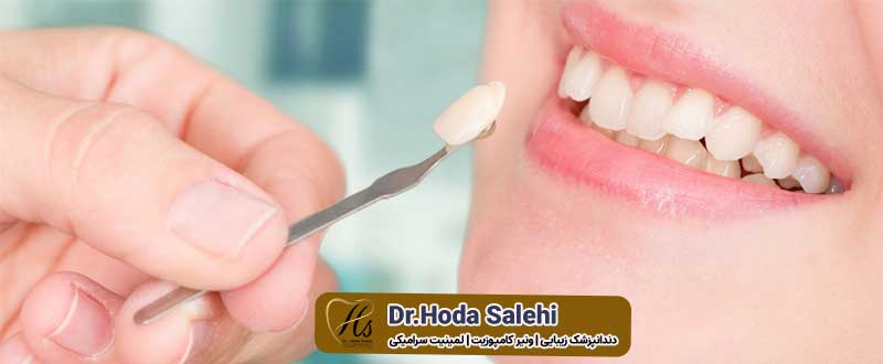 عوارض و معایب لمینت دندان