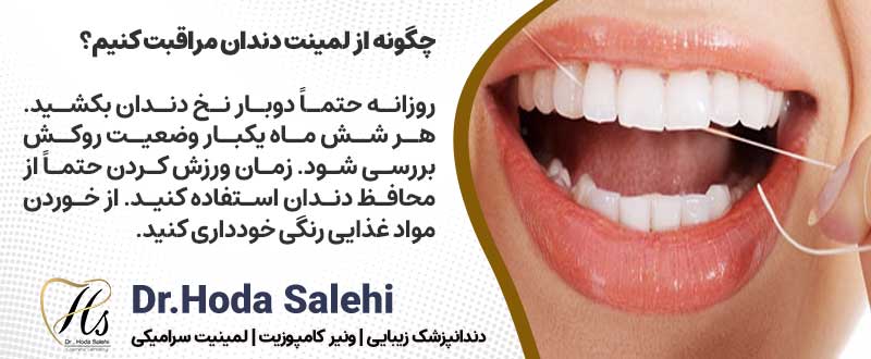 چگونه از لمینت دندان مراقبت کنیم؟