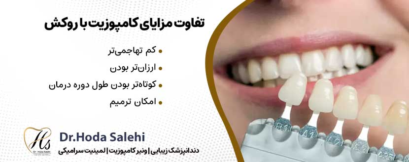 تفاوت مزایای کامپوزیت با روکش دندان|دکتر هدی صالحی دندانپزشک زیبایی