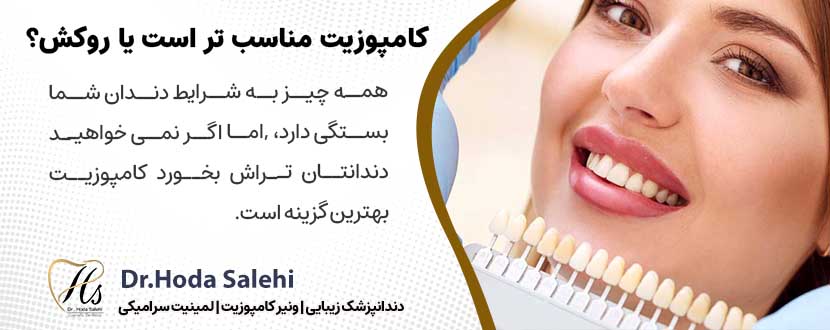 کامپوزیت مناسب تر است یا روکش دندان؟|دکتر هدی صالحی دندانپزشک زیبایی