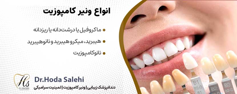 انواع کامپوزیت ونیر|دکتر هدی صالحی دندانپزشک زیبایی