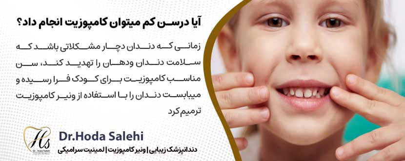 آیا درسنین کم میتوان کامپوزیت دندان انجام داد؟ |دکتر هدی صالحی دندانپزشک زیبایی در اصفهان