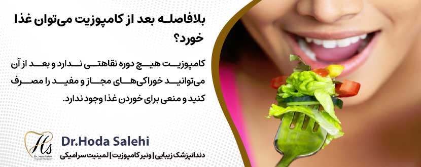 آیا بلافاصله بعد از کامپوزیت دندان می‌توان غذا خورد؟ |دکتر هدی صالحی دندانپزشک زیبایی در اصفهان