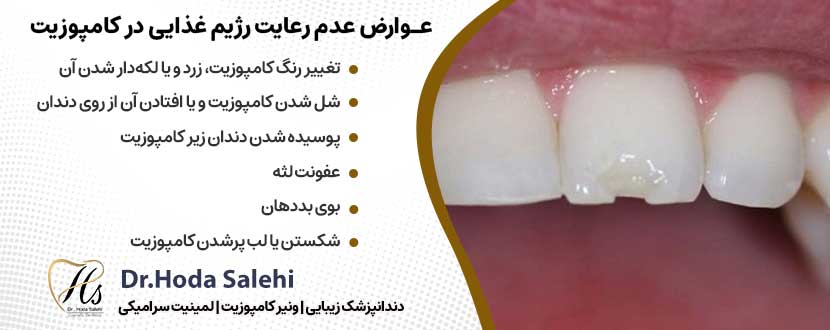 عوارض ناشی از عدم رعایت رژیم غذایی پس از کامپوزیت دندان |دکتر هدی صالحی دندانپزشک زیبایی در اصفهان