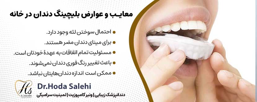 عوارض بلیچینگ دندان در خانه |دکتر هدی صالحی دندانپزشک زیبایی در اصفهان
