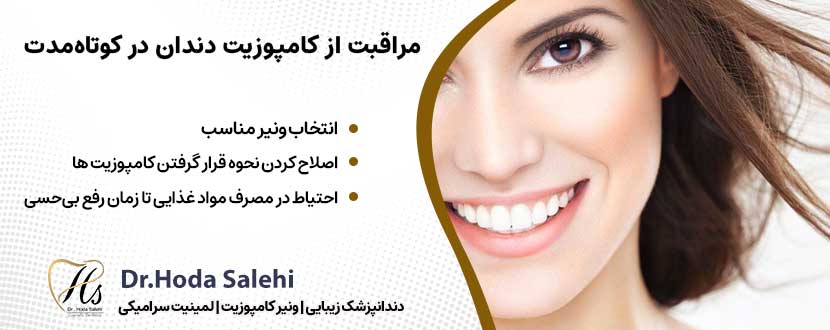 مراقبت از کامپوزیت دندان در کوتاه‌مدت |دکتر هدی صالحی دندانپزشک زیبایی در اصفهان