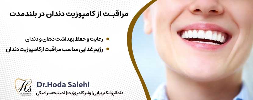 مراقبت از کامپوزیت دندان در بلندمدت |دکتر هدی صالحی دندانپزشک زیبایی در اصفهان
