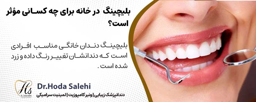 بلیچینگ دندان در خانه برای چه کسانی مؤثر است؟ |دکتر هدی صالحی دندانپزشک زیبایی در اصفهان