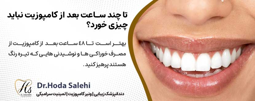 تا چند ساعت بعد از کامپوزیت نباید چیزی خورد؟ |دکتر هدی صالحی دندانپزشک زیبایی در اصفهان