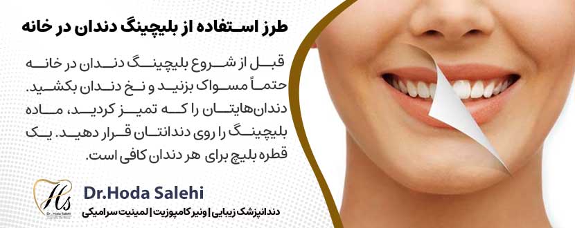 طرز استفاده از بلیچینگ دندان در خانه |دکتر هدی صالحی دندانپزشک زیبایی در اصفهان