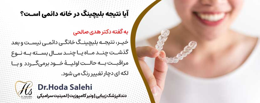 آیا نتیجه‌ بلیچینگ در خانه دائمی است؟ |دکتر هدی صالحی دندانپزشک زیبایی در اصفهان
