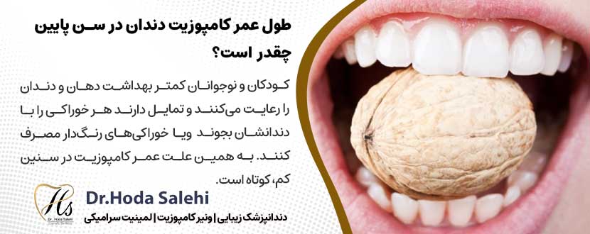 طول عمر کامپوزیت دندان در سن پایین چقدر است؟ |دکتر هدی صالحی دندانپزشک زیبایی در اصفهان