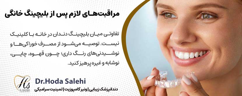 مراقبت‌های لازم پس از بلیچینگ خانگی  |دکتر هدی صالحی دندانپزشک زیبایی در اصفهان