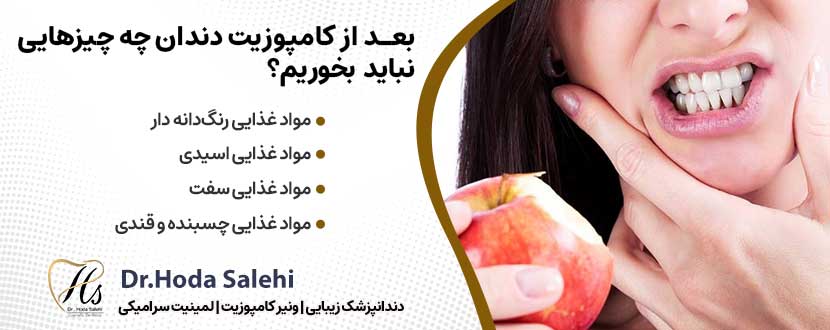 بعد از کامپوزیت دندان چه چیزهایی نباید بخوریم؟ |دکتر هدی صالحی دندانپزشک زیبایی در اصفهان