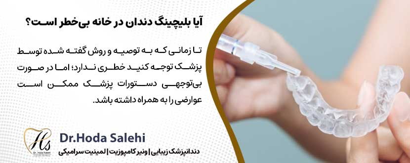 آیا بلیچینگ دندان در خانه بی‌خطر است؟ |دکتر هدی صالحی دندانپزشک زیبایی در اصفهان