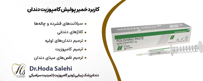 کاربرد خمیر پولیش کامپوزیت دندان |دکتر هدی صالحی دندانپزشک زیبایی در اصفهان