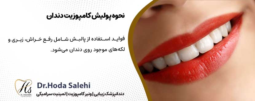 فواید استفاده از پولیش کامپوزیت |دکتر هدی صالحی دندانپزشک زیبایی در اصفهان