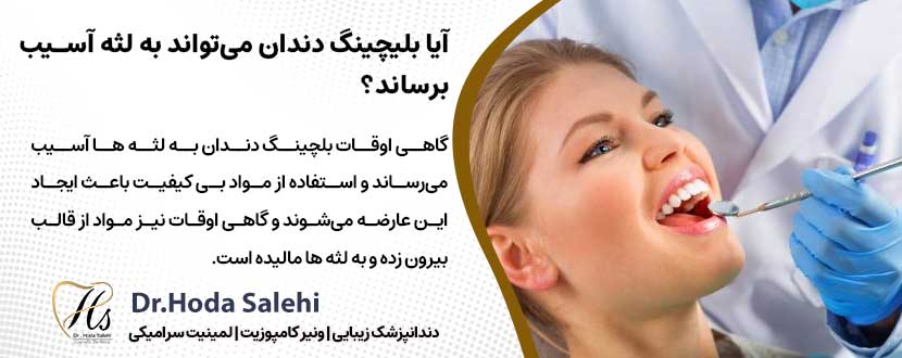 آیا بلیچینگ دندان می‌تواند به لثه آسیب برساند؟ |دکتر هدی صالحی دندانپزشک زیبایی در اصفهان
