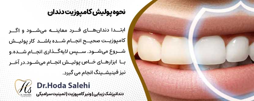 نحوه پولیش کامپوزیت دندان |دکتر هدی صالحی دندانپزشک زیبایی در اصفهان