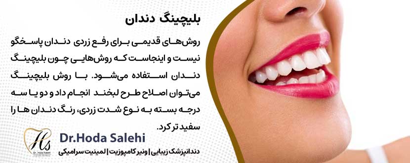 بلیچینگ دندان |دکتر هدی صالحی دندانپزشک زیبایی در اصفهان