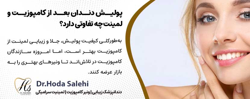 پولیش دندان بعد از کامپوزیت و لمینت چه تفاوتی دارد؟ |دکتر هدی صالحی دندانپزشک زیبایی در اصفهان