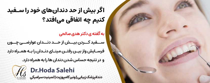 اگر بیش از حد دندان‌های خود را سفید کنید چه اتفاقی می‌افتد؟ |دکتر هدی صالحی دندانپزشک زیبایی در اصفهان