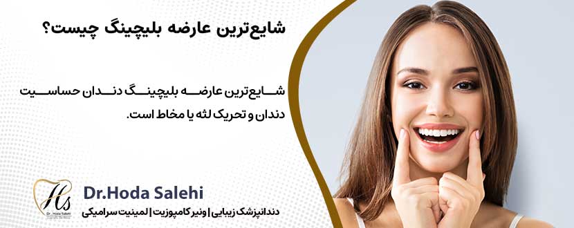 شایع‌ترین عارضه بلیچینگ دندان چیست؟ |دکتر هدی صالحی دندانپزشک زیبایی در اصفهان