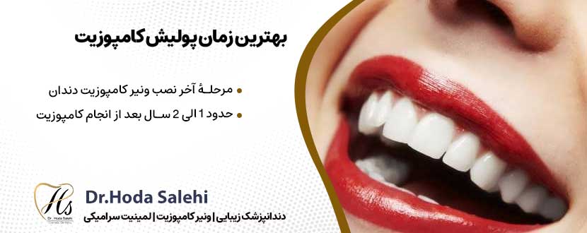 بهترین زمان پولیش کامپوزیت |دکتر هدی صالحی دندانپزشک زیبایی در اصفهان