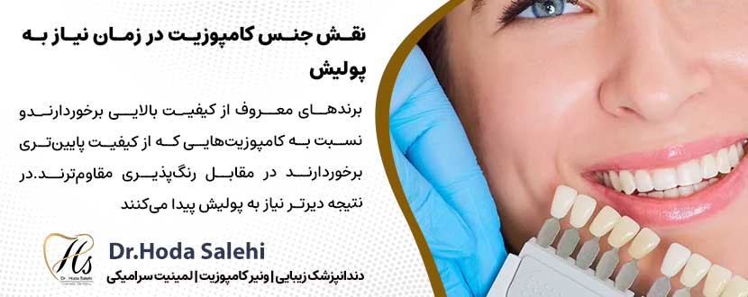 نقش جنس کامپوزیت در زمان نیاز به پولیش آن |دکتر هدی صالحی دندانپزشک زیبایی در اصفهان