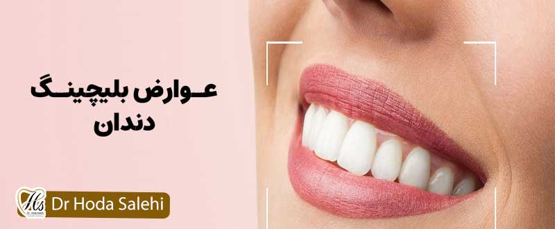 عوارض بلیچینگ دندان |دکتر هدی صالحی دندانپزشک زیبایی در اصفهان