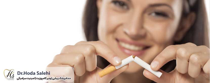 افراد سیگاری لمینت کنند یا کامپوزیت؟