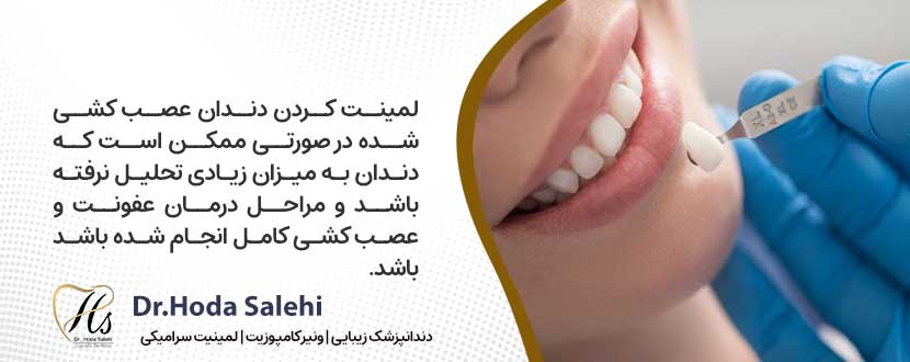 امکان پذیر بودن لمینت دندان پس از عصب کشی