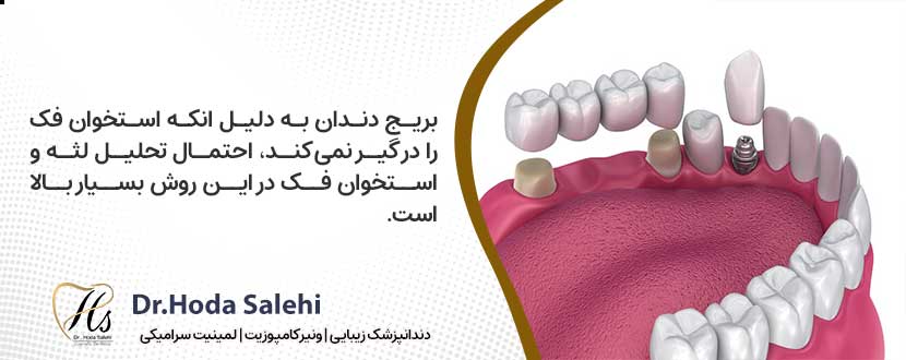 معایب و عوارض پل دندانی