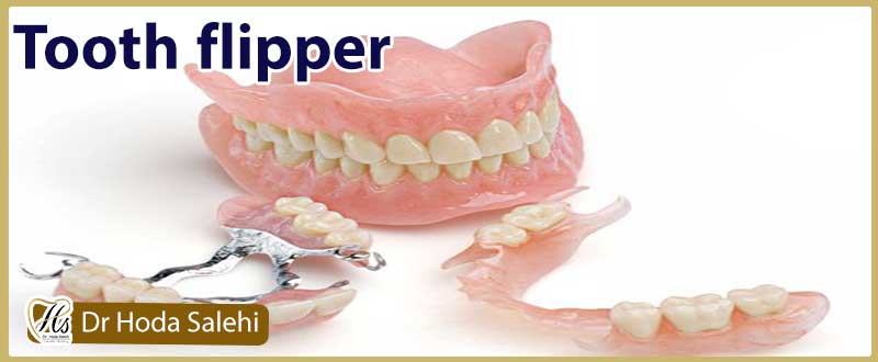 فلیپر دندان چیست؟